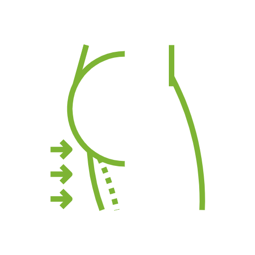 Versteviging van de huid