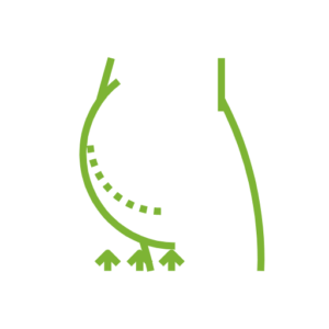 Zionic vermindert Cellulitis